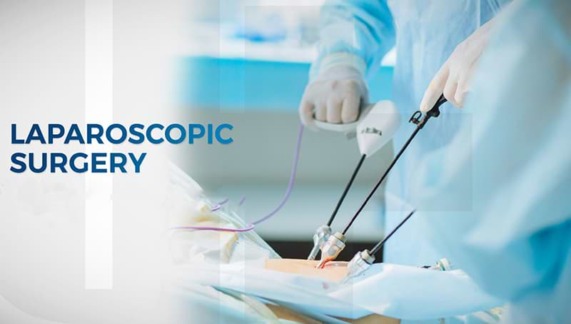 Laparoscopic Surgery: Advancements and Benefits in General Surgery