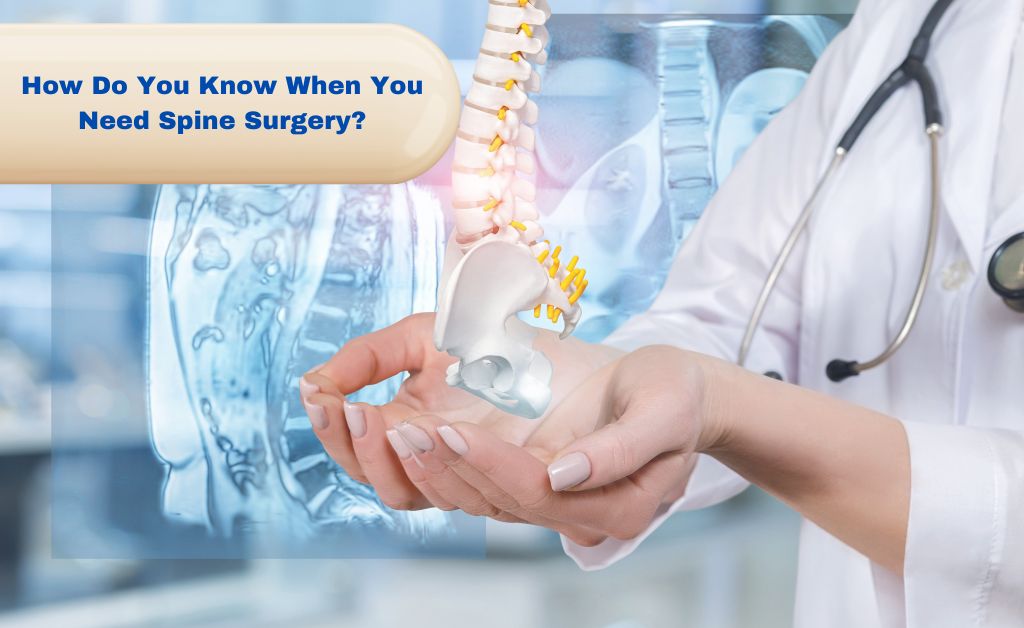 How Do You Know When You Need Spine Surgery