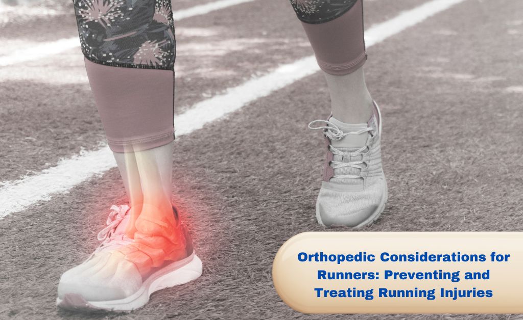 Orthopedic Considerations for Runners: Preventing and Treating Running Injuries