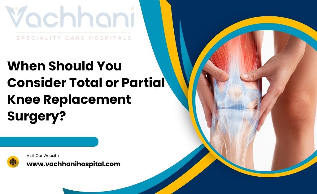 When Should You Consider Total or Partial Knee Replacement Surgery